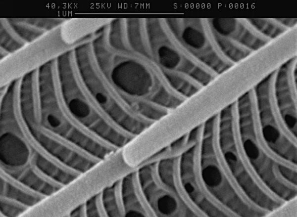 SCHMETTERLINGSSCHUPPEN_090125_110142