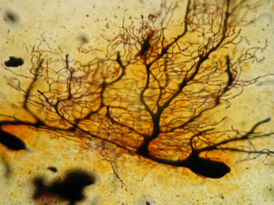 Nervenzelle im Kleinhirn