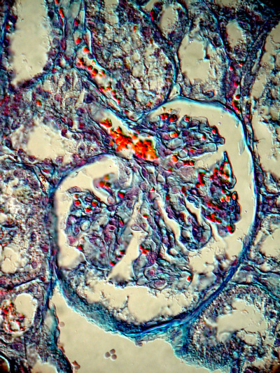 Glomerulum in der Niere