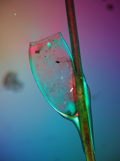 Nisse einer Kopflaus