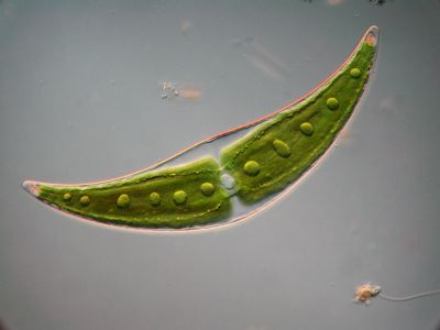 Alge der Gattung Closterium