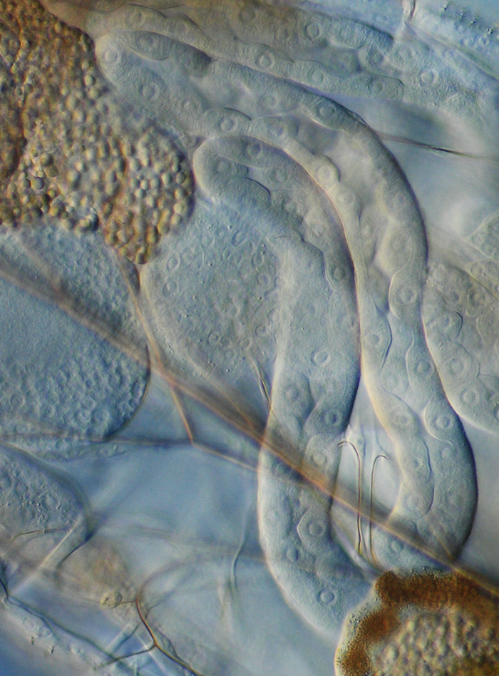 Innereien der Larve einer Taufliege (Fruchtfliege, Drosophila melanogaster) mit Riesenzellkernen in den Speicheldrüsen