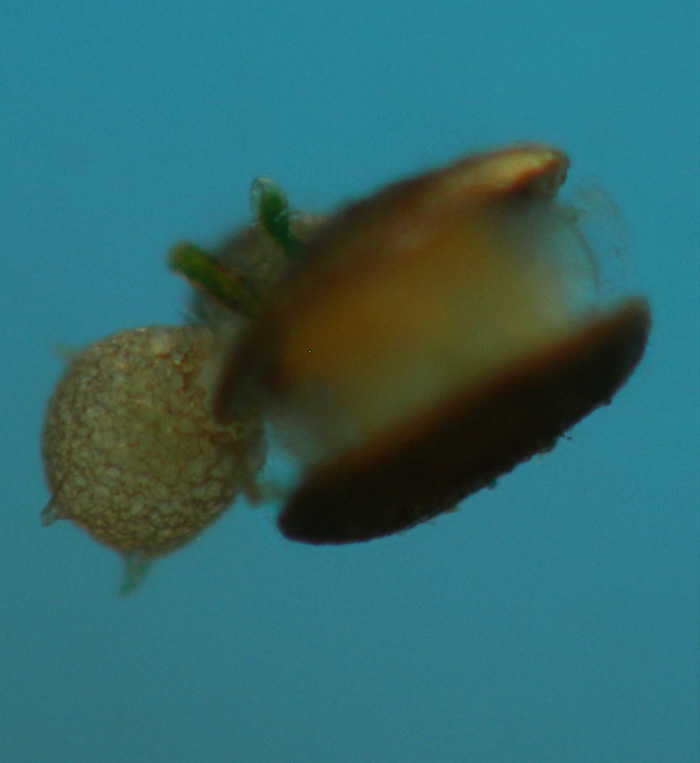 Flottoblast mit Schalenamöbe