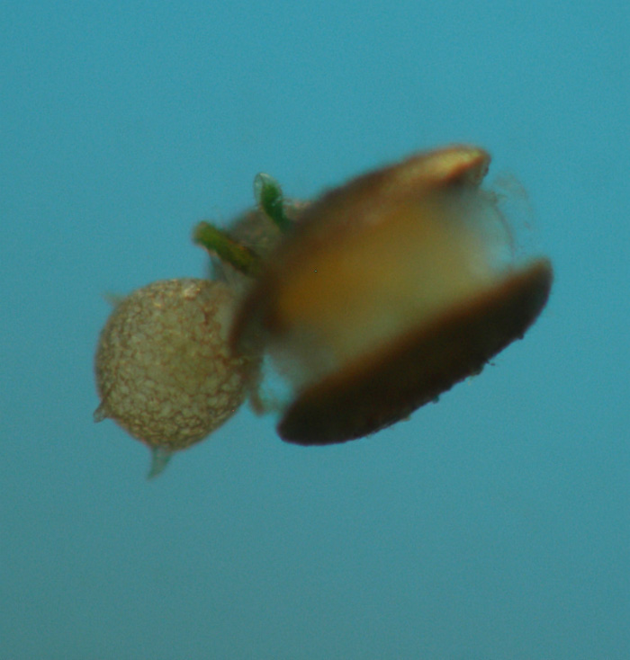 Flottoblast mit Schalenamöbe