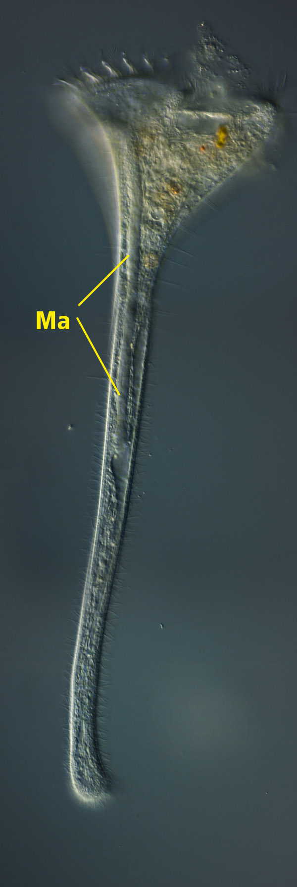 Stentor roeselii mit unsegmentiertem Makronukleus
