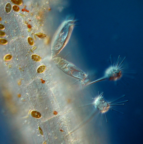 Cothurnia und Suctoren