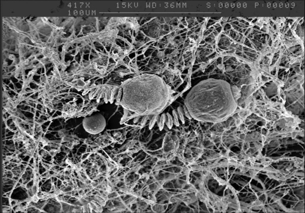 Glockentierchen im Rasterelektronenmikroskop