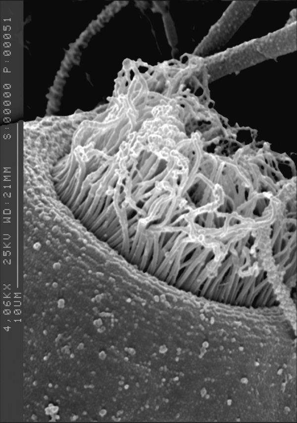 Glockentierchen im Rasterelektronenmikroskop