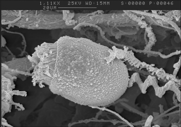 Glockentierchen im Rasterelektronenmikroskop