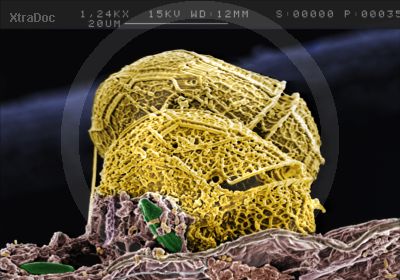 Panzergeh�use zweier Dinoflagellaten