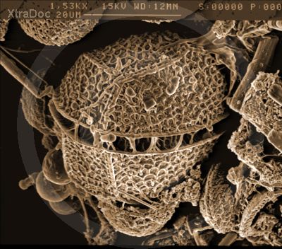 Elektronenmikroskopisches Bild eines Dinoflagellaten-Panzers