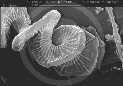 Stiel einer Vorticella (Wimperntierchen). Rasterelektronenmikroskopische Aufnahme.