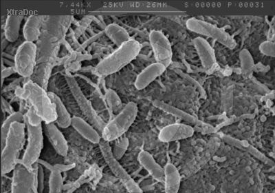 Bakterien auf verrottendem Material im Wasser -REM-Bild