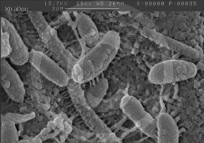 Bakterien auf verrottendem Material im Wasser - rasterelektronenmikroskopisches Bild