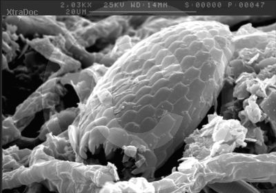 Verlassenes Geh�use einer Schalenam�be (Euglypha)