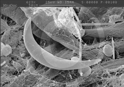 Sichelalge aus einheimischen Gew�ssern