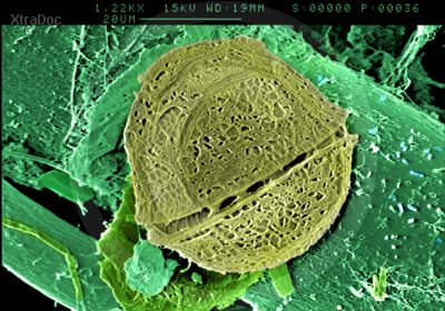 Dinoflagellat