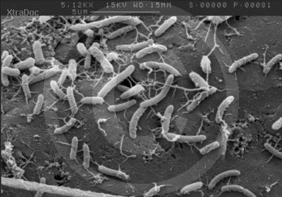 Bakterien auf verrottendem Pflanzenmaterial im Wasser - rasterelektronenmikroskopische Aufnahme