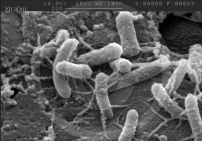 Bakterien auf verrottendem organischem Material im Wasser, Rasterelektronenmikroskop