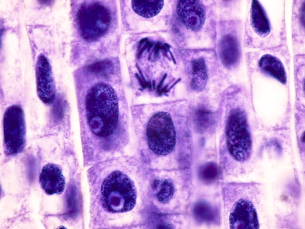 Wurzelspitze eines Bohnenkeims mit Mitose (Kernteilungsfigur)