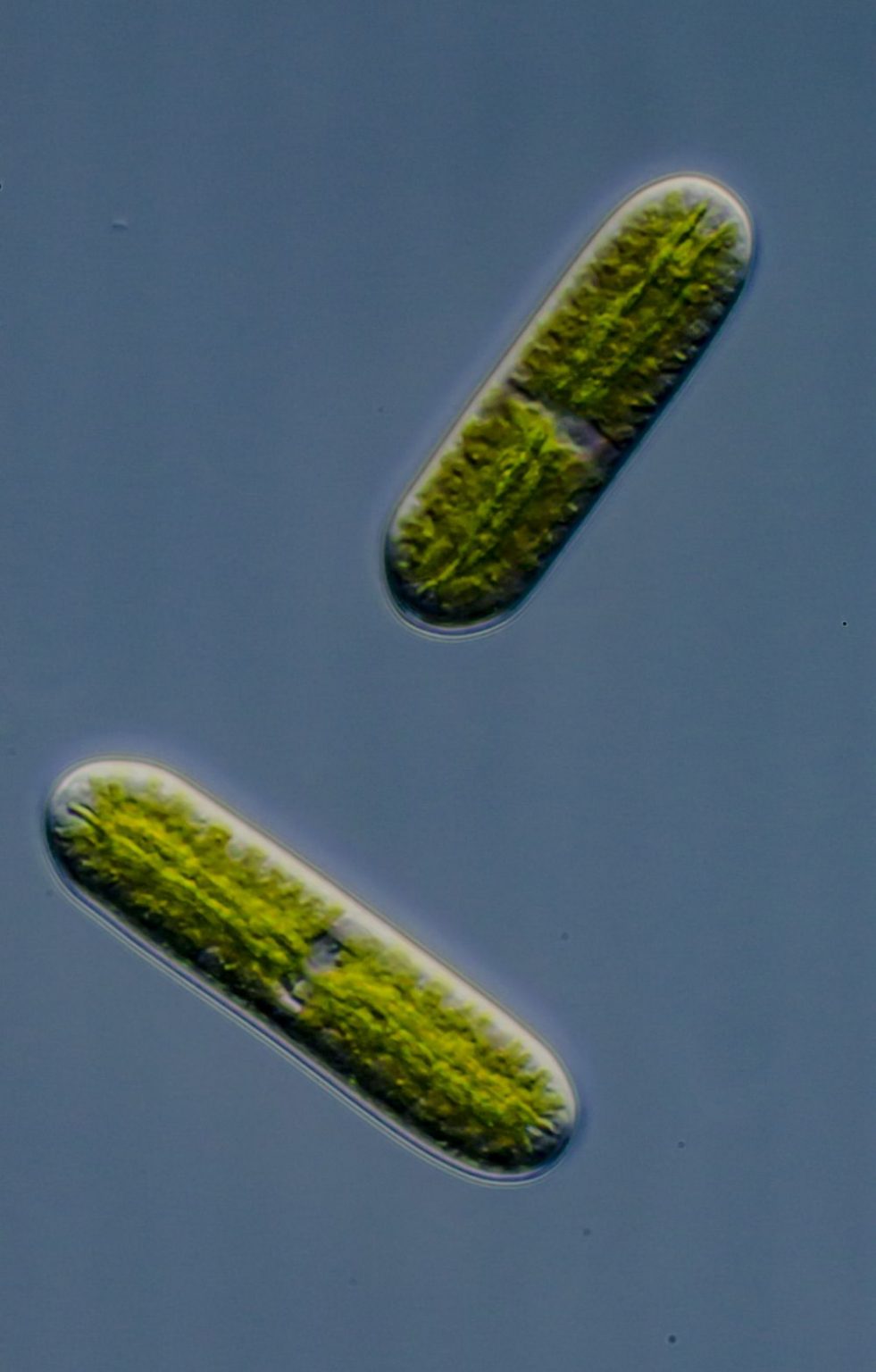 » Netrium oblongum BeWie's Mikrowelt (single)